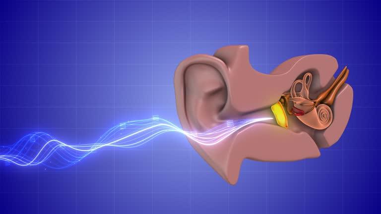 tympanoplasty