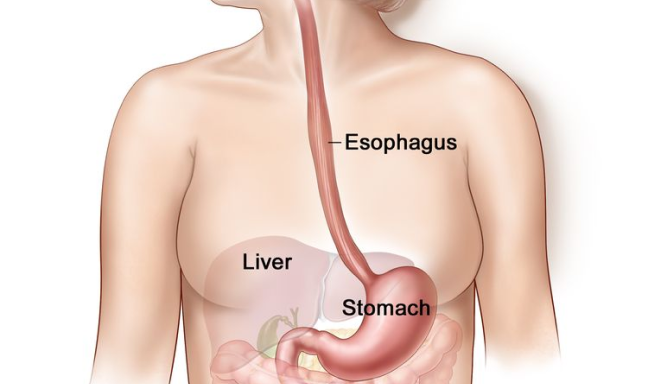 Esophageal-Cancer-Treatment