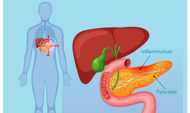 Pancreatic-Cancer-Treatment