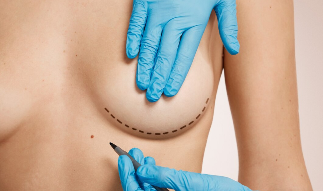 Anal-Cancer-Treatment