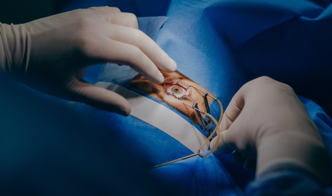 Corneal-Transplant-Surgery