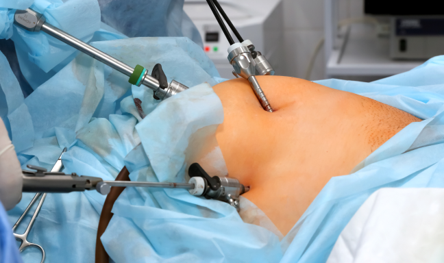 Vaginal-Hysterectomy