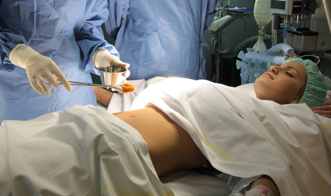 Anal-Cancer-Treatment